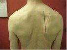 scapular areas for corrective shoulder program